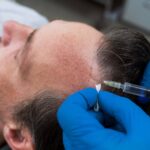 Best Hair Loss Treatment in Noida