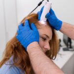Best Hair Loss Treatment in Noida