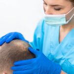 Best Hair Fall Treatment in Noida