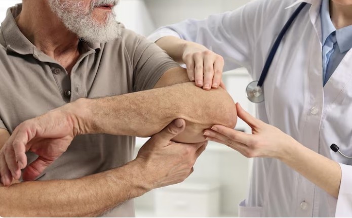 Best Arthritis Treatment in Noida