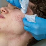 Best Skin Problems Treatment in Noida