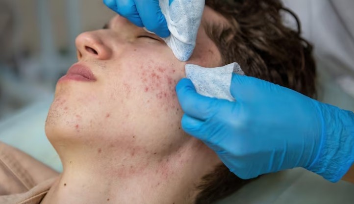Best Skin Problems Treatment in Noida