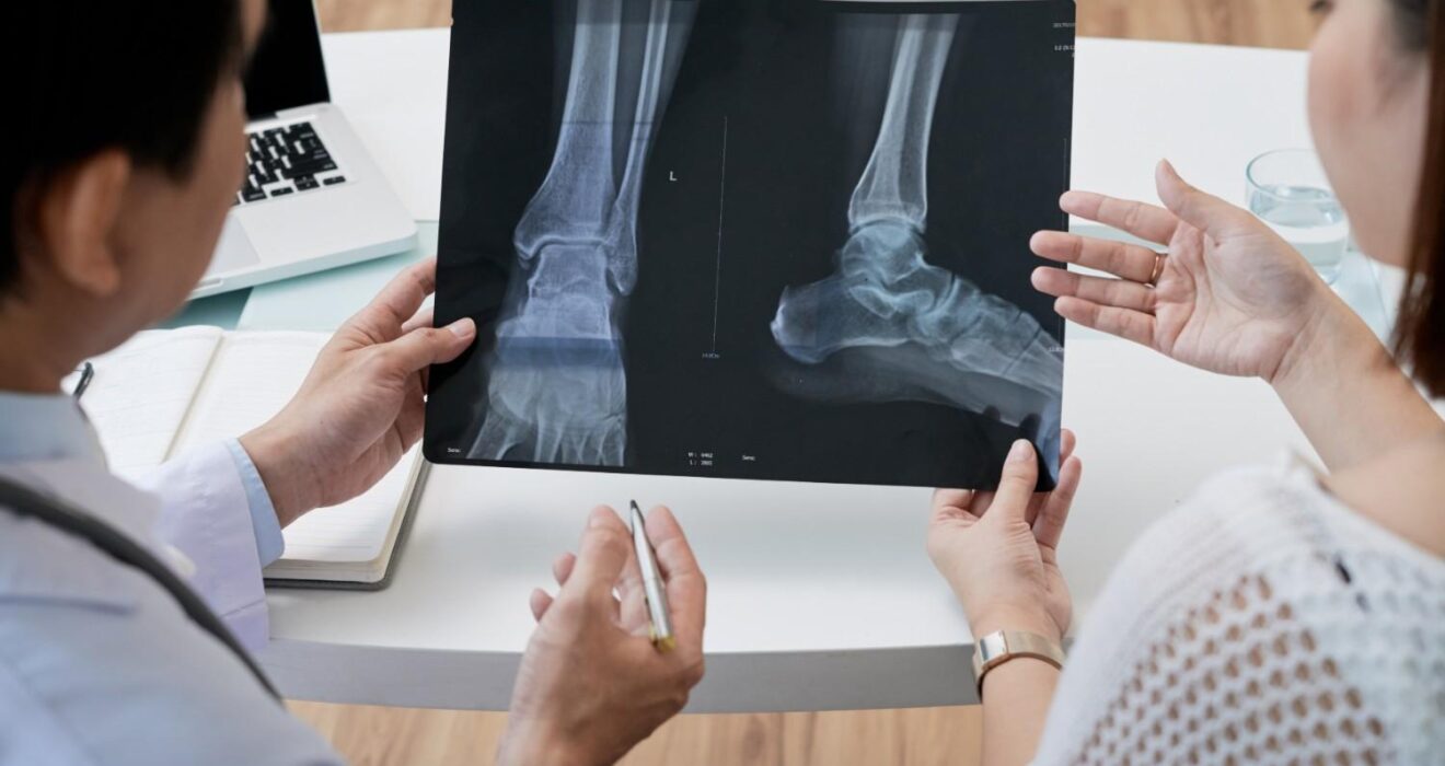 Bone Deformities Treatment in Noida