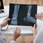 Bone Deformities Treatment in Noida