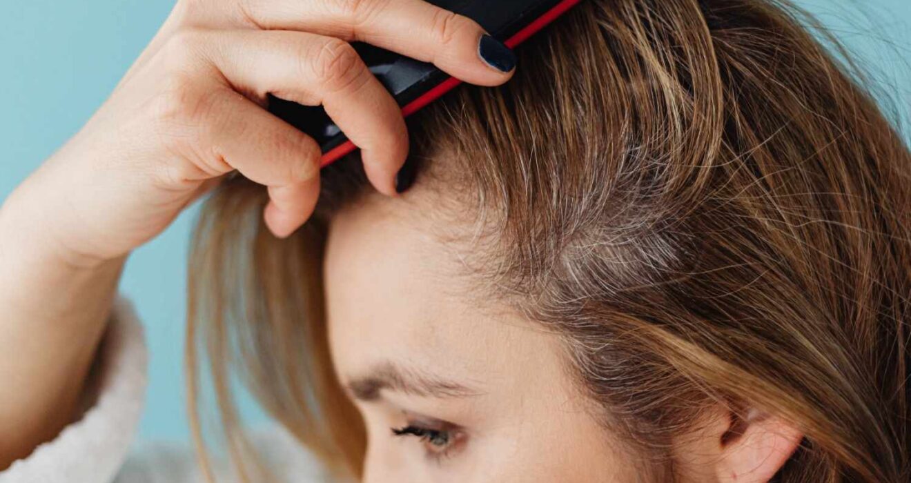 Hair Thinning Treatment in Noida