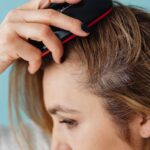 Hair Thinning Treatment in Noida