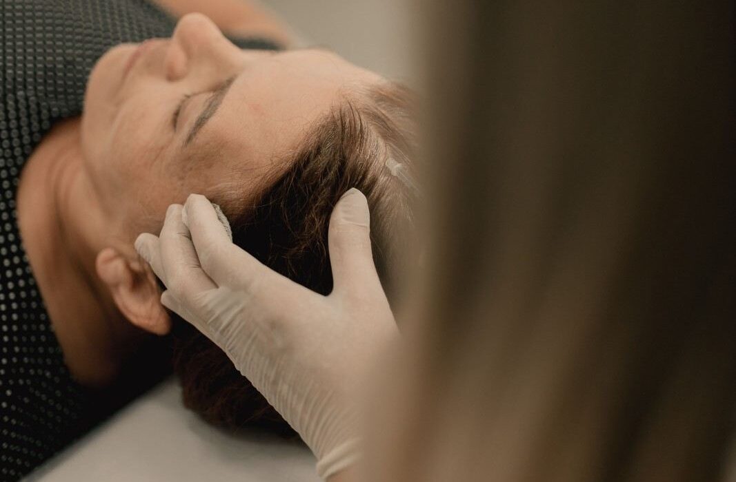 Hair Thinning Treatment in Noida